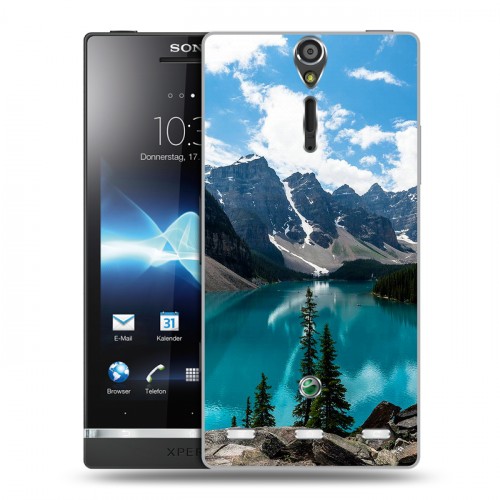 Дизайнерский пластиковый чехол для Sony Xperia S Озера