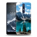 Дизайнерский пластиковый чехол для Nokia 5.1 Озера