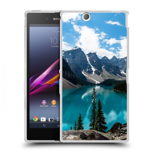 Дизайнерский пластиковый чехол для Sony Xperia Z Ultra  Озера