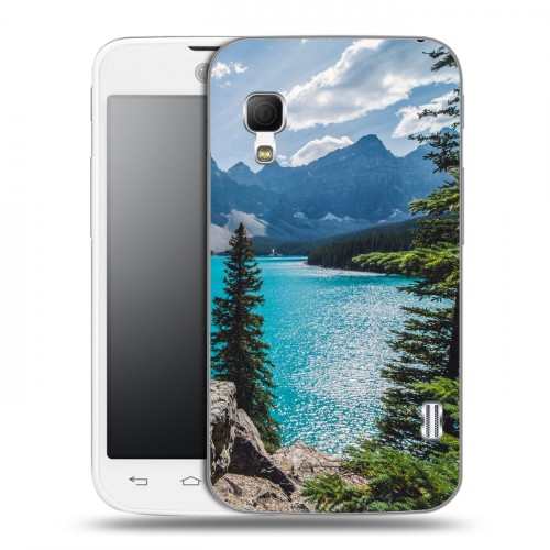 Дизайнерский пластиковый чехол для LG Optimus L5 2 II Озера
