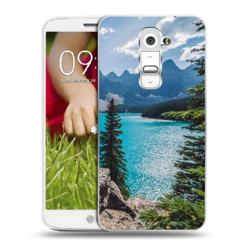 Дизайнерский пластиковый чехол для LG Optimus G2 mini Озера