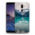 Дизайнерский пластиковый чехол для Nokia 7 Plus Озера