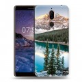 Дизайнерский пластиковый чехол для Nokia 7 Plus Озера