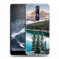 Дизайнерский пластиковый чехол для Nokia 5.1 Озера