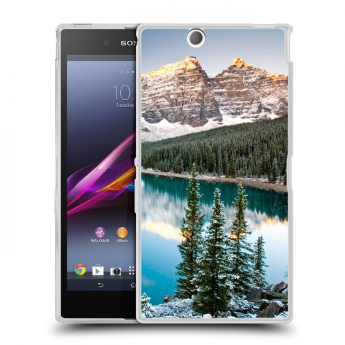 Дизайнерский пластиковый чехол для Sony Xperia Z Ultra  Озера