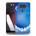 Дизайнерский пластиковый чехол для LG V20 Небо