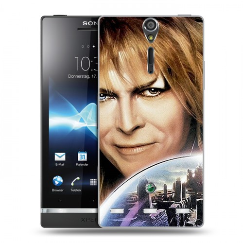 Дизайнерский пластиковый чехол для Sony Xperia S