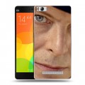 Дизайнерский пластиковый чехол для Xiaomi Mi4i