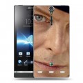 Дизайнерский пластиковый чехол для Sony Xperia S