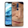 Дизайнерский пластиковый чехол для Nokia 5.1 Plus