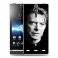 Дизайнерский пластиковый чехол для Sony Xperia S