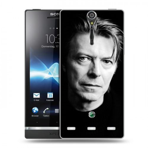 Дизайнерский пластиковый чехол для Sony Xperia S