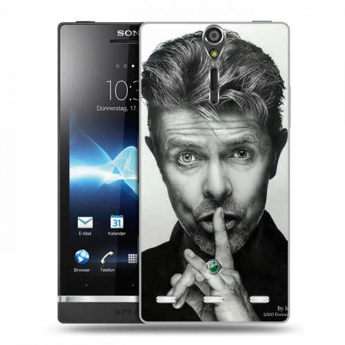 Дизайнерский пластиковый чехол для Sony Xperia S