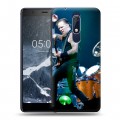 Дизайнерский пластиковый чехол для Nokia 5.1