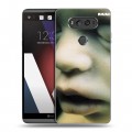 Дизайнерский пластиковый чехол для LG V20