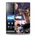 Дизайнерский пластиковый чехол для Sony Xperia S