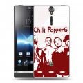 Дизайнерский пластиковый чехол для Sony Xperia S