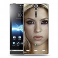 Дизайнерский пластиковый чехол для Sony Xperia S