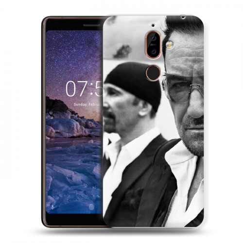 Дизайнерский пластиковый чехол для Nokia 7 Plus