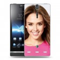 Дизайнерский пластиковый чехол для Sony Xperia S