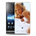 Дизайнерский пластиковый чехол для Sony Xperia S