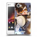 Дизайнерский пластиковый чехол для Sony Xperia L