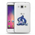 Полупрозрачный дизайнерский пластиковый чехол для LG L60