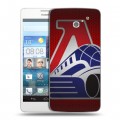 Дизайнерский пластиковый чехол для Huawei Ascend D2