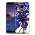 Дизайнерский пластиковый чехол для Nokia 7 Plus