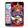 Дизайнерский пластиковый чехол для Nokia Lumia 1320