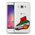 Полупрозрачный дизайнерский пластиковый чехол для LG L60