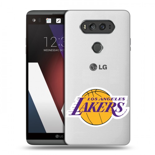 Полупрозрачный дизайнерский пластиковый чехол для LG V20 НБА