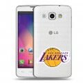 Полупрозрачный дизайнерский пластиковый чехол для LG L60 НБА