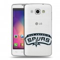 Дизайнерский пластиковый чехол для LG L60