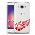 Полупрозрачный дизайнерский пластиковый чехол для LG L60