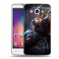 Дизайнерский пластиковый чехол для LG L60 Dota 2