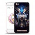 Дизайнерский пластиковый чехол для Xiaomi RedMi 5A League of Legends