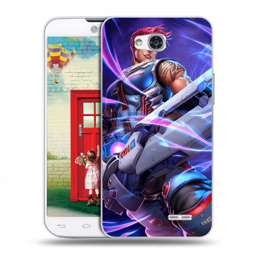 Дизайнерский пластиковый чехол для LG L80 Overwatch