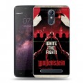 Дизайнерский силиконовый чехол для Homtom HT17 Wolfenstein