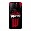 Дизайнерский пластиковый чехол для Xiaomi Poco M3 Wolfenstein