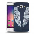 Дизайнерский пластиковый чехол для LG L60 Coldplay