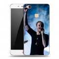 Дизайнерский пластиковый чехол для ZTE Nubia N1 Imagine Dragons