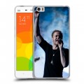 Дизайнерский пластиковый чехол для Xiaomi Mi Note Imagine Dragons