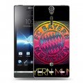 Дизайнерский пластиковый чехол для Sony Xperia S Бавария