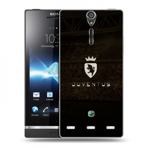 Дизайнерский пластиковый чехол для Sony Xperia S Ювентус