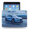 Дизайнерский силиконовый чехол для Xiaomi MiPad Hyundai