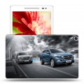 Дизайнерский силиконовый чехол для ASUS ZenPad 8 hyundai