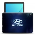 Дизайнерский силиконовый чехол для Huawei MediaPad M5 10.8 hyundai