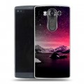 Дизайнерский пластиковый чехол для LG V10 ночь