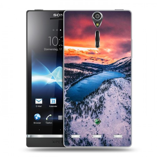 Дизайнерский пластиковый чехол для Sony Xperia S озеро